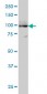 ATP2A3 Antibody (monoclonal) (M01)