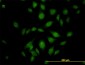 ATP2C1 Antibody (monoclonal) (M01)