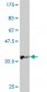 ATP7B Antibody (monoclonal) (M01)