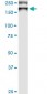 ATP7B Antibody (monoclonal) (M01)