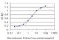 ATRX Antibody (monoclonal) (M01)