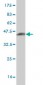 ATRX Antibody (monoclonal) (M01)