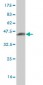 ATRX Antibody (monoclonal) (M01)