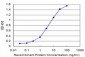 AXIN1 Antibody (monoclonal) (M01)