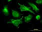 B2M Antibody (monoclonal) (M01)