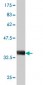 B2M Antibody (monoclonal) (M01)