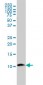 B2M Antibody (monoclonal) (M01)