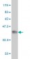 BAAT Antibody (monoclonal) (M02)