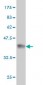 BAAT Antibody (monoclonal) (M02)