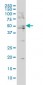 BAAT Antibody (monoclonal) (M02)