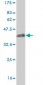 BACH1 Antibody (monoclonal) (M02)