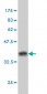 BAG1 Antibody (monoclonal) (M01)