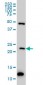 BAG2 Antibody (monoclonal) (M01)