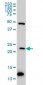 BAG2 Antibody (monoclonal) (M01)