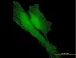 BARD1 Antibody (monoclonal) (M01)