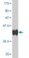 BARX1 Antibody (monoclonal) (M05)