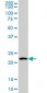 BARX1 Antibody (monoclonal) (M05)