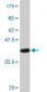 BCAP31 Antibody (monoclonal) (M01)