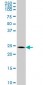 BCAS2 Antibody (monoclonal) (M01)