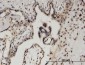 BCL11A Antibody (monoclonal) (M03)