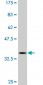 BCL11A Antibody (monoclonal) (M03)