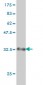 BDKRB2 Antibody (monoclonal) (M01)
