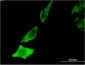 BDNF Antibody (monoclonal) (M02)