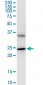 BDNF Antibody (monoclonal) (M02)