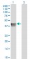 BGN Antibody (monoclonal) (M01)