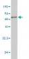 BGN Antibody (monoclonal) (M02)