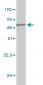 BGN Antibody (monoclonal) (M02)