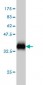 BIRC5 Antibody (monoclonal) (M01)