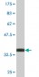 BLMH Antibody (monoclonal) (M02)