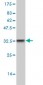 BLR1 Antibody (monoclonal) (M01)