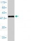 BLVRA Antibody (monoclonal) (M01)