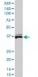 BLVRA Antibody (monoclonal) (M01)