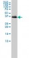 BLVRA Antibody (monoclonal) (M01)