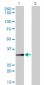 BLVRA Antibody (monoclonal) (M01)