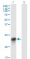 BLVRB Antibody (monoclonal) (M09)