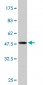 BRMS1 Antibody (monoclonal) (M01)