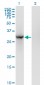 BRMS1 Antibody (monoclonal) (M01)