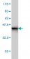 BUB1B Antibody (monoclonal) (M01)