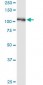 BUB1B Antibody (monoclonal) (M01)