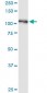 BUB1B Antibody (monoclonal) (M01)