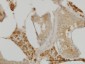 C10orf7 Antibody (monoclonal) (M08)