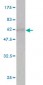 CA1 Antibody (monoclonal) (M02)