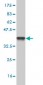 CA12 Antibody (monoclonal) (M01)