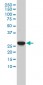 CA3 Antibody (monoclonal) (M02)