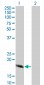 CABP4 Antibody (monoclonal) (M02)