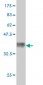 CACNB2 Antibody (monoclonal) (M01)
